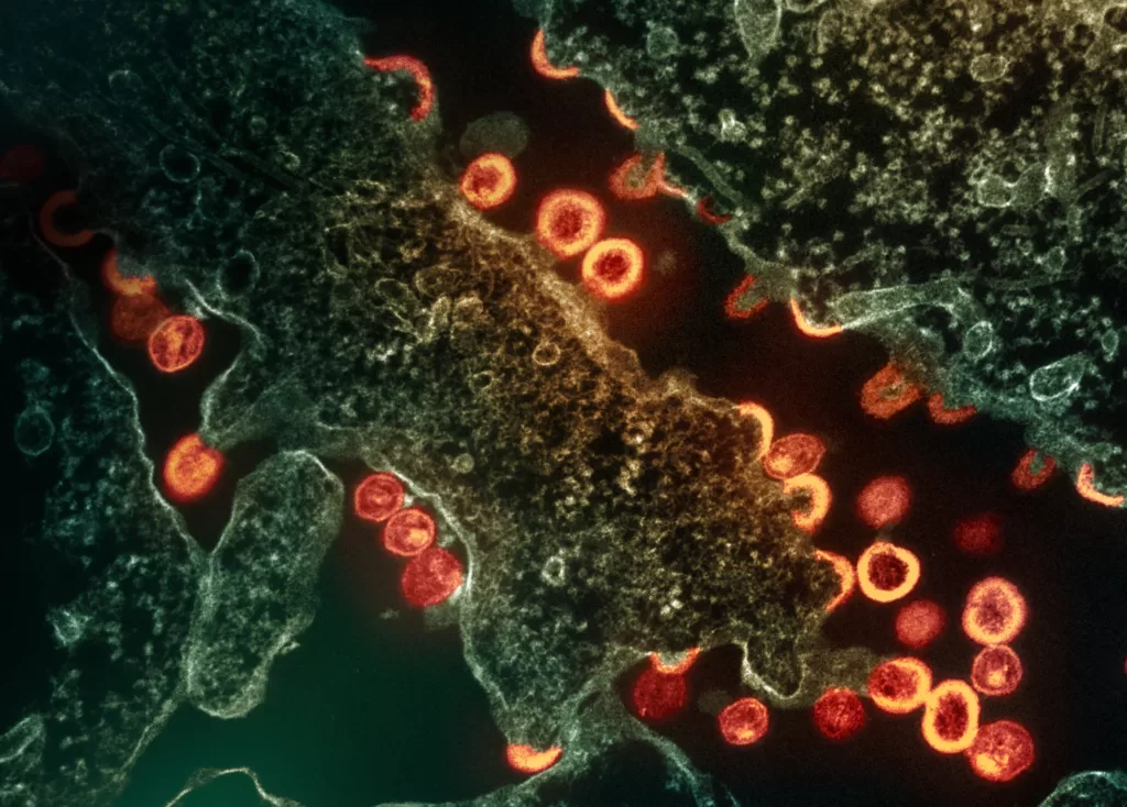 HIV virus particles (red/gold) budding and replicating from a chronically infected H9 cell (green). : Flickr: NIAID CC BY 2.0